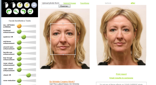 facelift Facelift, cirug		</div>
		<div class=